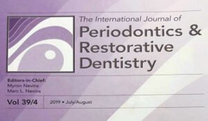 Leia mais sobre o artigo PROSPECTIVE 1-Year Study of Immediately Loaded Implants: 8-Patient Case Series Report